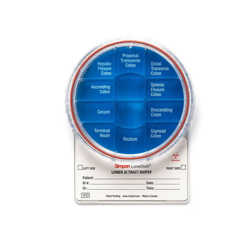 CoreDish biopsy containers, half pre-filled 10% formalin