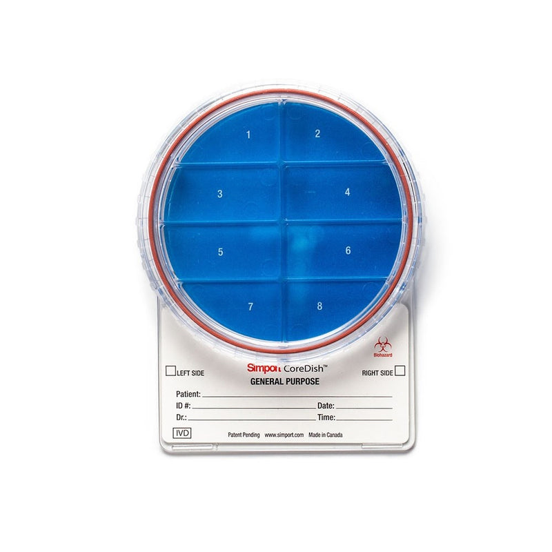 CoreDish biopsy containers, half pre-filled 10% formalin