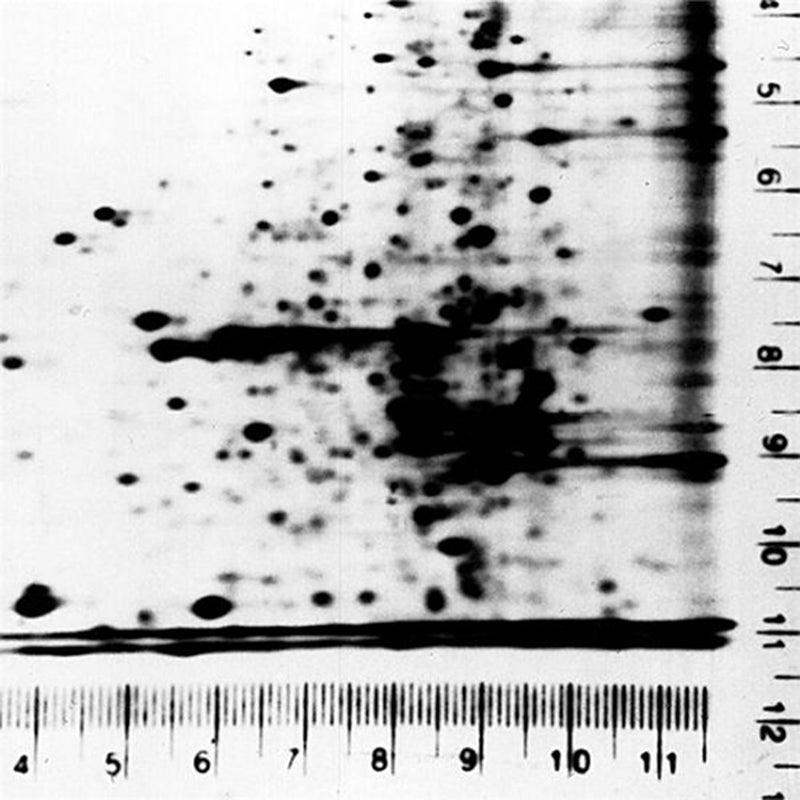 Autoradiography ruler set