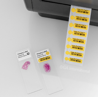 Histo-PinTAG removable microscope slide re-identification thermal transfer labels